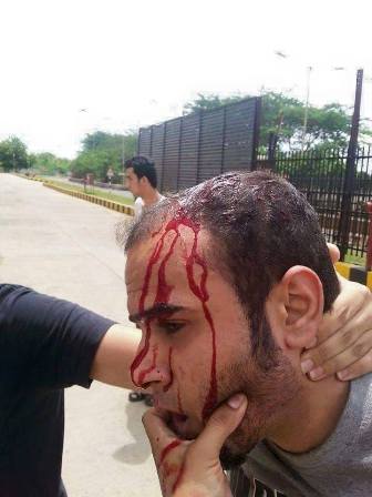  Photos: Iraqi students are exposed to severe beatings in India