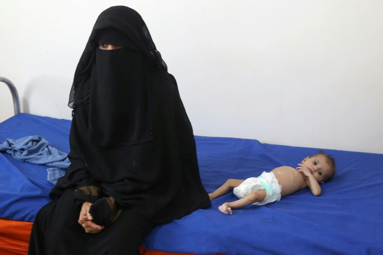  Saudi tries its hand at rebuilding a ‘destroyed’ Yemen