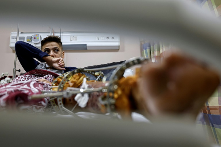  Far from the violence, Gaza wounded find care at Cairo hospital